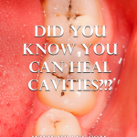 heal-cavities-naturally-dr-axe